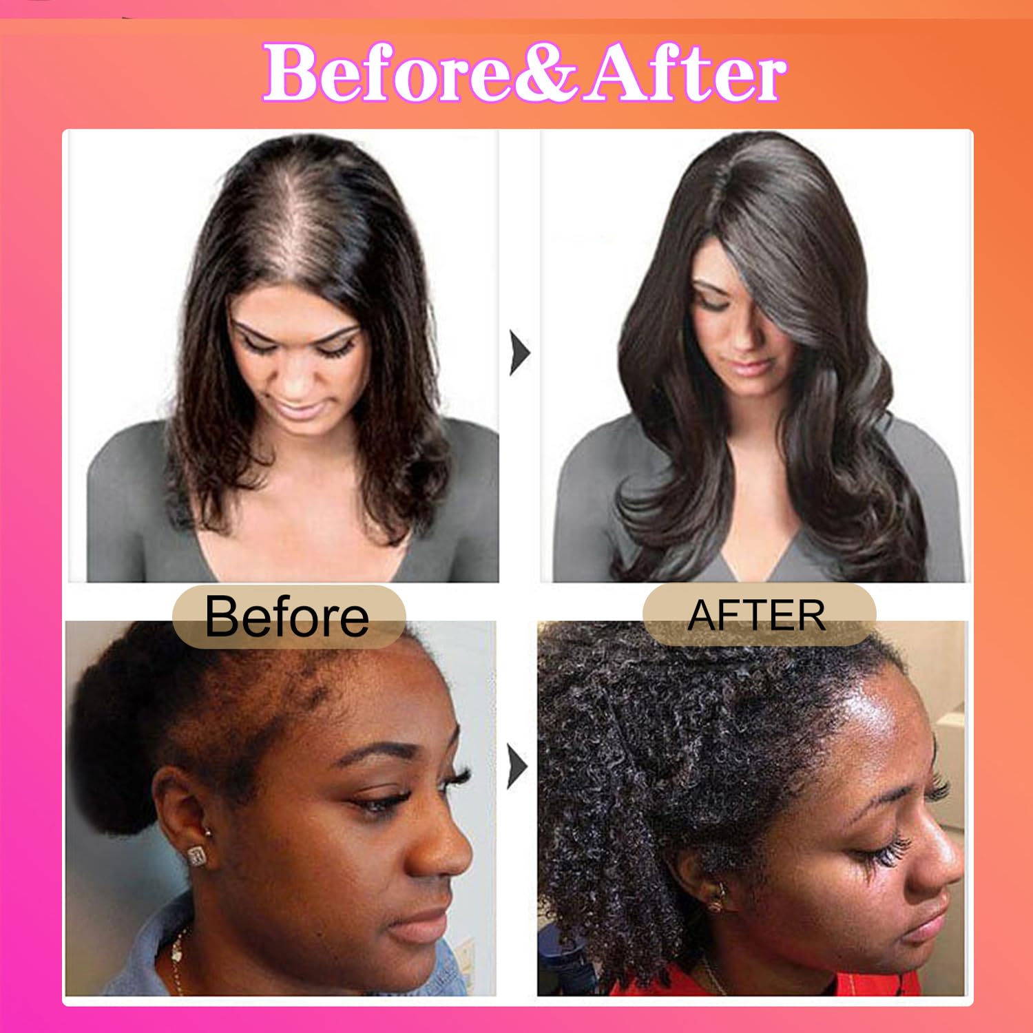 Batana Oil for Hair Growth, Unrefined Organic Pure Batana Butter Conditioner I93024